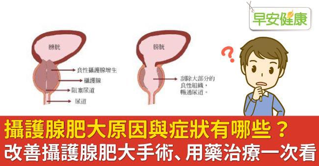 攝護腺肥大的患者不建議一次服用兩顆犀利士5mg，避免引起副作用